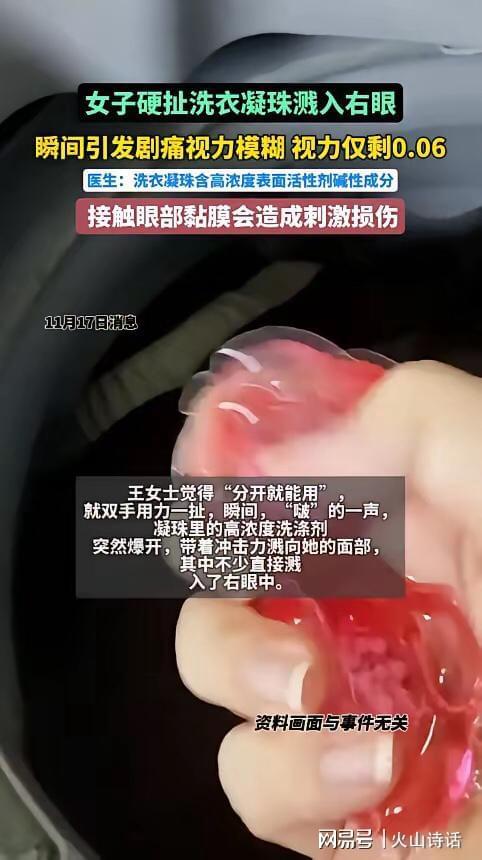 州一女子撕扯凝珠发生意外致眼睛失明瓦力游戏恐怖！洗衣引发“爆